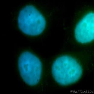 ZWINT Antibody - ZW10 interactor avatar