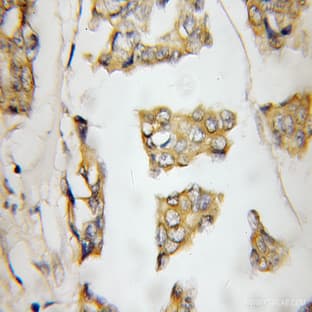 Gamma cystathionase Antibody - cystathionase (cystathionine gamma-lyase)