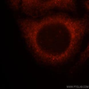 14-3-3 epsilon Antibody - tyrosine 3-monooxygenase/tryptophan 5-monooxygenase activation protein, epsilon polypeptide
