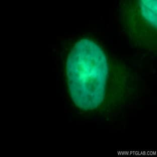 CDK4 Antibody - cyclin-dependent kinase 4