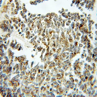 Aconitase 2 Antibody - aconitase 2, mitochondrial