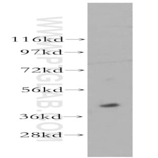 ACOT7L Antibody - acyl-CoA thioesterase 7 pseudogene