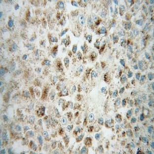 ACOX1 Antibody - acyl-Coenzyme A oxidase 1, palmitoyl