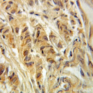 ACOT11 Antibody - acyl-CoA thioesterase 11