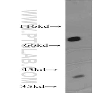 Zyxin Antibody - zyxin avatar