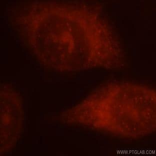 5 Lipoxygenase Antibody - arachidonate 5-lipoxygenase