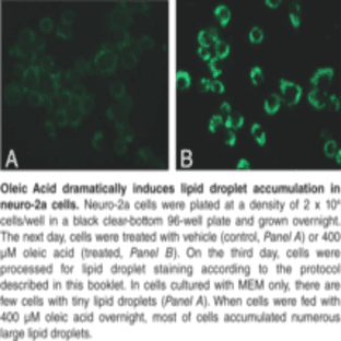 Lipid Droplets Fluorescence Assay Kit