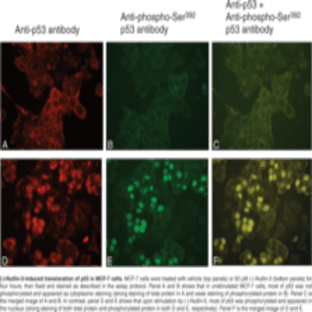 p53 Total and p53 (Phospho-Ser392) Dual Staining Assay Kit