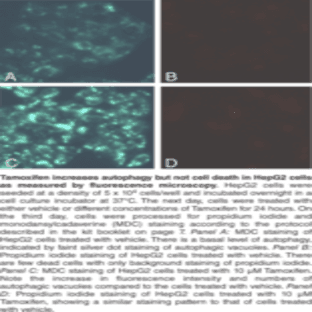Autophagy/Cytotoxicity Dual Staining Kit