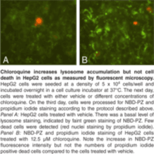 Lysosome/Cytotoxicity Dual Staining Kit