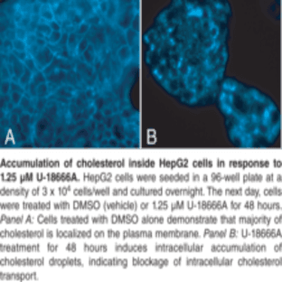 Cholesterol Cell-Based Detection Assay Kit avatar