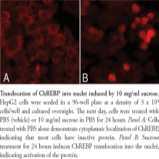 ChREBP Cell-Based Translocation Assay Kit avatar