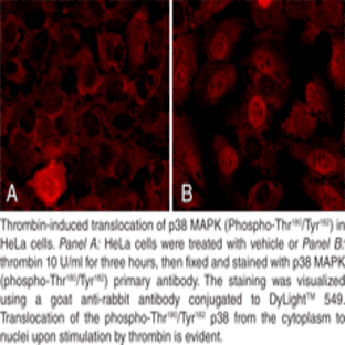 p38 MAPK (Phospho-Thr180/Tyr182) Cell-Based Phosphorylation/Translocation Assay Kit