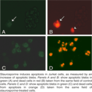 Apoptotic Blebs Assay Kit