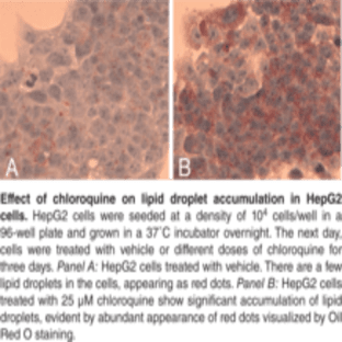 Steatosis Colorimetric Assay Kit avatar