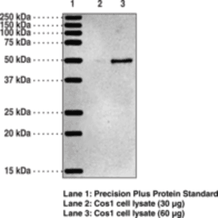 5-OxoETE Receptor Polyclonal Antibody avatar
