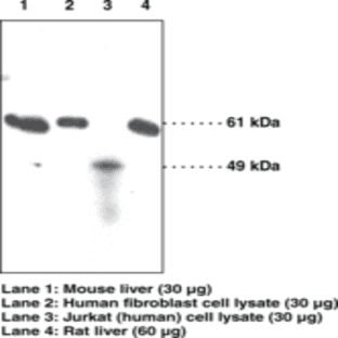 SOAT-2/ACAT-2 Polyclonal Antibody