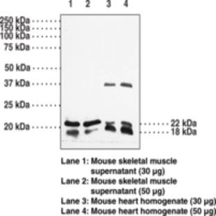Caveolin 1/3 Polyclonal Antiserum avatar