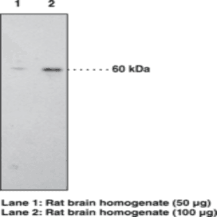 CB1 Receptor Polyclonal Antibody avatar