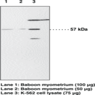 PPAR(alpha) Polyclonal Antibody avatar