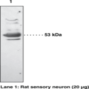 EP3 Receptor Polyclonal Antibody
