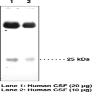 Prostaglandin D Synthase (lipocalin-type) Polyclonal Antibody avatar