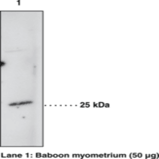 Prostaglandin D Synthase (hematopoietic-type) Polyclonal Antibody avatar