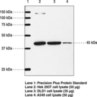 IP Receptor (mouse) Polyclonal Antibody avatar