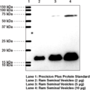 Prostaglandin E Synthase-1 (microsomal) Polyclonal Antibody avatar