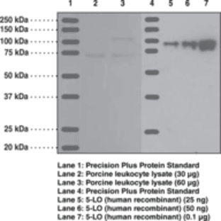 5-Lipoxygenase Polyclonal Antibody avatar