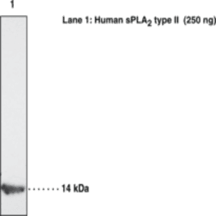 sPLA2 (human Type IIA) Monoclonal Antibody (Clone SCACC353) avatar