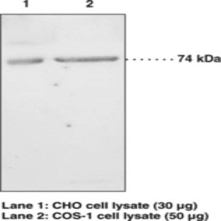 iPLA2 (Type VI) Polyclonal Antibody
