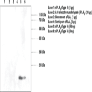 sPLA2 (human Type V) Monoclonal Antibody (Clone MCL-3G1) avatar