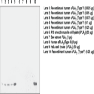 sPLA2 (mouse Type V) Polyclonal Antibody avatar