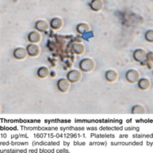 Thromboxane Synthase Polyclonal Antibody avatar