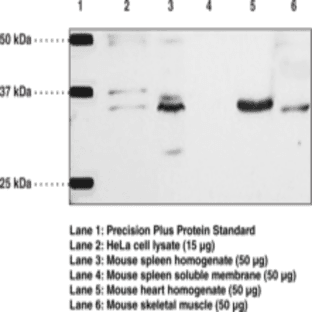 TRAIL Polyclonal Antibody avatar