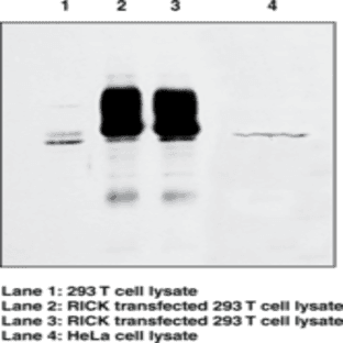 RICK Polyclonal Antibody
