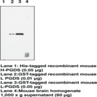 Prostaglandin D Synthase (lipocalin-type; mouse) Polyclonal Antibody avatar