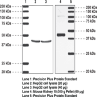 TP Receptor (human) Polyclonal Antibody avatar