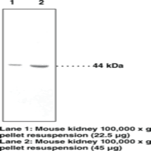 11(beta)-Hydroxysteroid Dehydrogenase (Type 2) Polyclonal Antibody