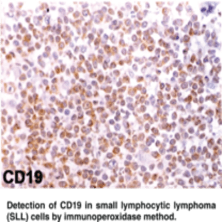 CD19 Monoclonal Antibody (Clone CB19) avatar
