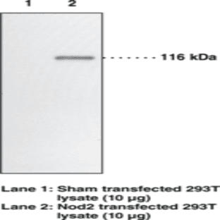 Nod2 Monoclonal Antibody (Clone 2D9)