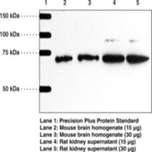 Serine Palmitoyltransferase Polyclonal Antibody