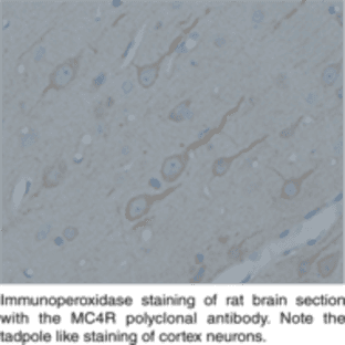 Melanocortin-4 Receptor Polyclonal Antibody