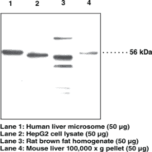 Adipose Triglyceride Lipase Polyclonal Antibody avatar