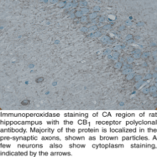 CB1 Receptor (C-Term) Polyclonal Antibody avatar