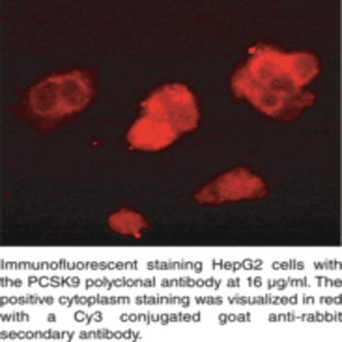 PCSK9 (human) Polyclonal Antibody