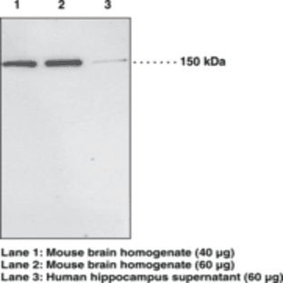 PH Domain Leucine-rich Repeat Protein Phosphatase 1 Polyclonal Antibody avatar