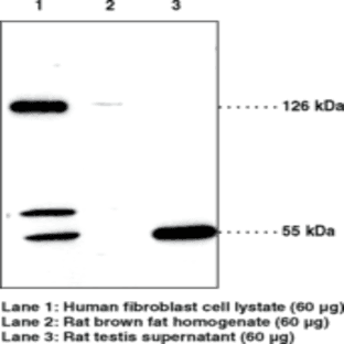 SREBP-2 Polyclonal Antibody avatar