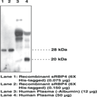 Serum Retinol Binding Protein 4 Polyclonal Antibody
